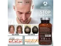 Advanced Trichology Dht Blocker With Immune Support - Hair Loss Supple..