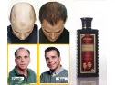 Hair Nurturing Anti Hair Loss Shampoo Available At Online Sale In Paki..