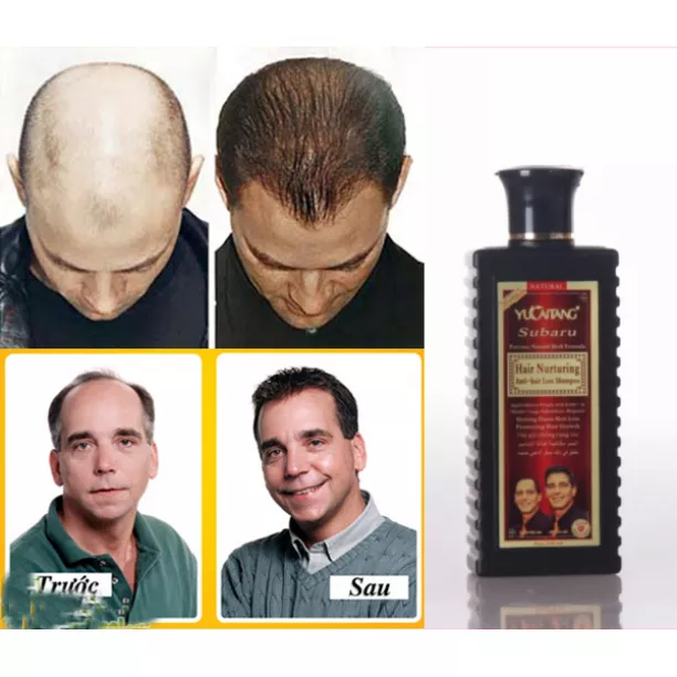 Hair Nurturing Anti Hair Loss Shampoo Available at Online Sale in Pakistan  | Shoppingate.Pk